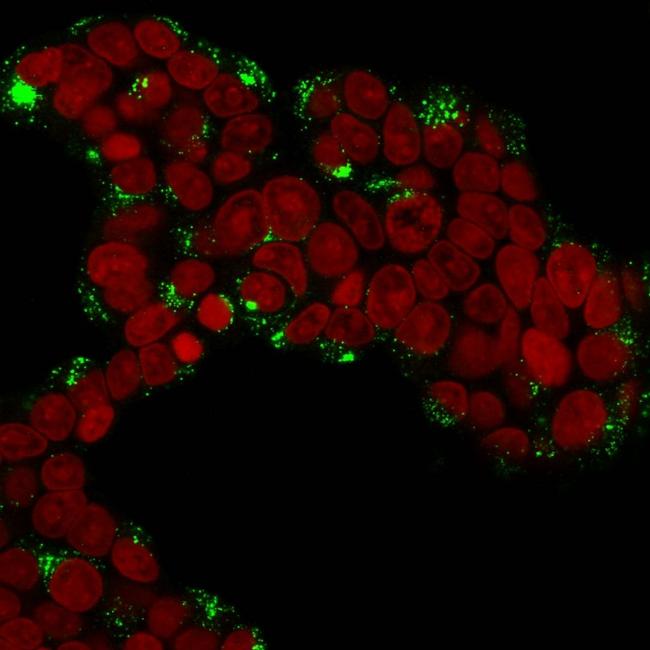 Cathepsin D Antibody in Immunocytochemistry (ICC/IF)