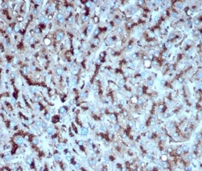 Cathepsin D (Tumor Marker) Antibody in Immunohistochemistry (Paraffin) (IHC (P))