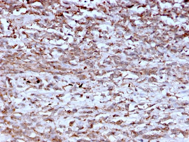 Cathepsin K Antibody in Immunohistochemistry (Paraffin) (IHC (P))