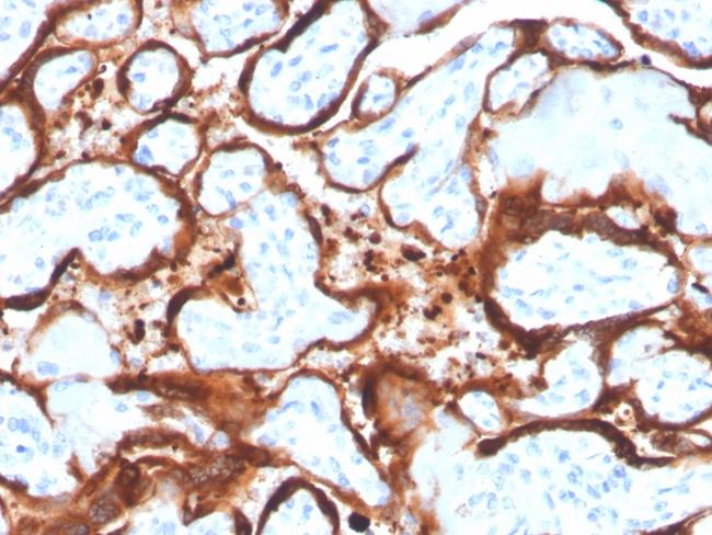 Aromatase/Cytochrome P450 (CYP19A1) Antibody in Immunohistochemistry (Paraffin) (IHC (P))