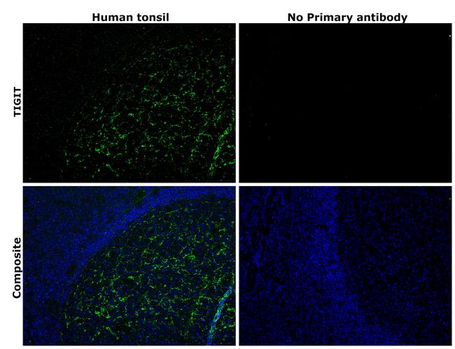 TIGIT Antibody in Immunohistochemistry (Paraffin) (IHC (P))