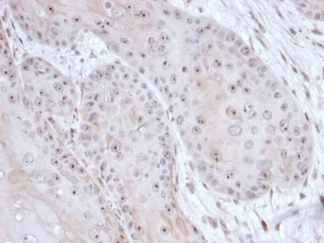 DAXX (Transcriptional Corepressor) Antibody in Immunohistochemistry (Paraffin) (IHC (P))