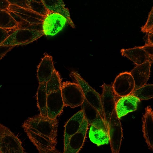 Zinc Finger Protein 846/ZNF846 Antibody in Immunocytochemistry (ICC/IF)