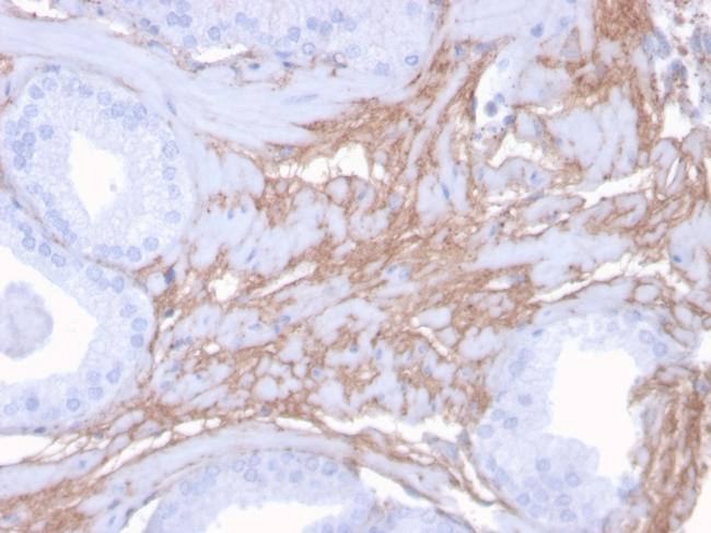 Decorin Antibody in Immunohistochemistry (Paraffin) (IHC (P))