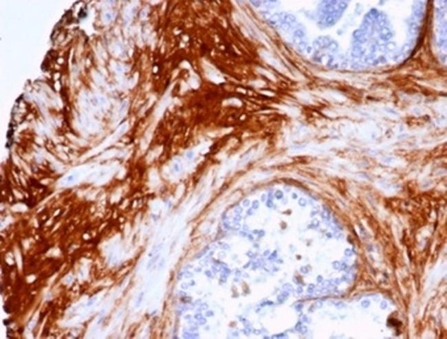 Decorin Antibody in Immunohistochemistry (Paraffin) (IHC (P))