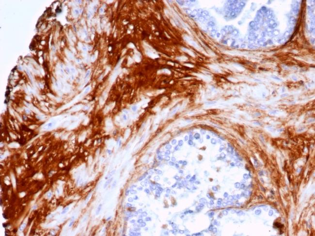 Decorin Antibody in Immunohistochemistry (Paraffin) (IHC (P))