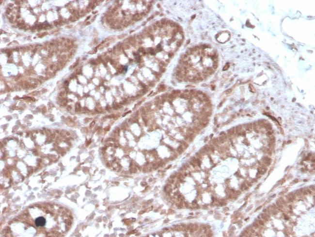 Angiotensin I Converting Enzyme (ACE)/CD143 Antibody in Immunohistochemistry (Paraffin) (IHC (P))