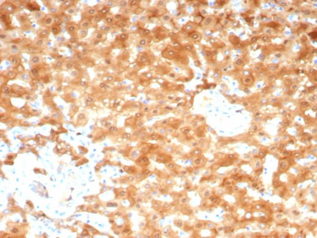 Aldo-keto Reductase Family 1 Member C1/DD1 Antibody in Immunohistochemistry (Paraffin) (IHC (P))