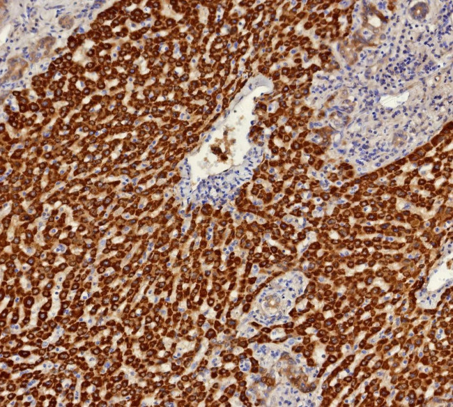 Aldo-keto Reductase Family 1 Member C1/DD1 Antibody in Immunohistochemistry (Paraffin) (IHC (P))