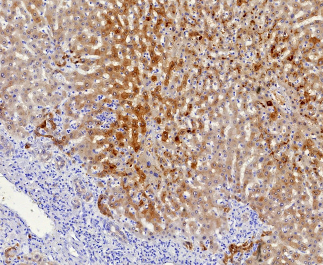 Aldo-keto Reductase Family 1 Member C1/DD1 Antibody in Immunohistochemistry (Paraffin) (IHC (P))