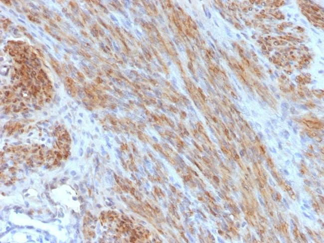 Desmin (Muscle Cell Marker) Antibody in Immunohistochemistry (Paraffin) (IHC (P))