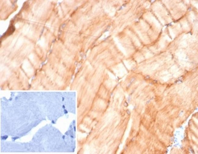 Desmin (Muscle Cell Marker) Antibody in Immunohistochemistry (Paraffin) (IHC (P))