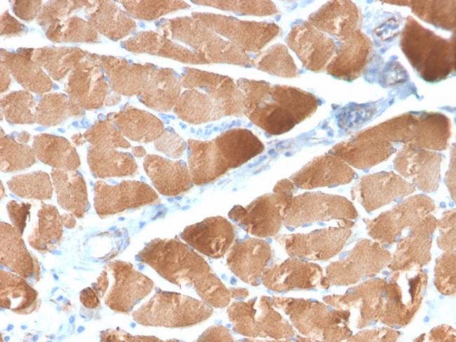 Desmin Antibody in Immunohistochemistry (Paraffin) (IHC (P))