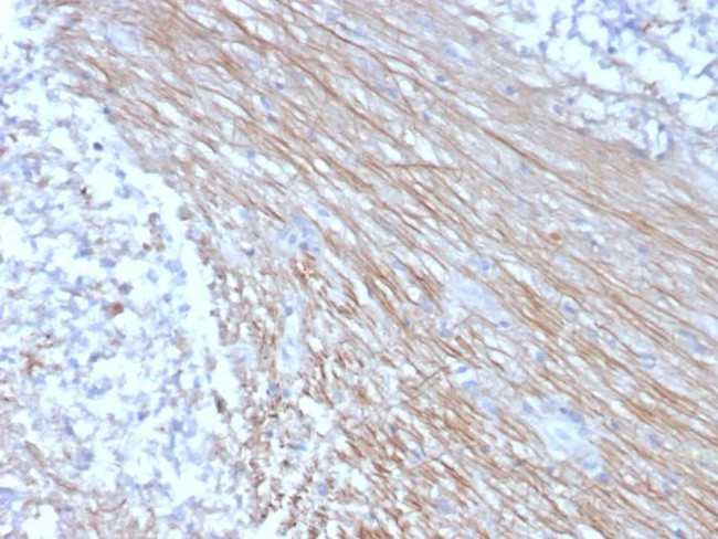 CD303/CLEC4C Antibody in Immunohistochemistry (Paraffin) (IHC (P))