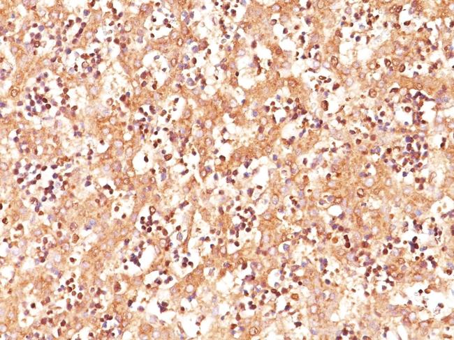 AFP (Alpha Fetoprotein) (Hepatocellular/Germ Cell Tumor Marker) Antibody in Immunohistochemistry (Paraffin) (IHC (P))