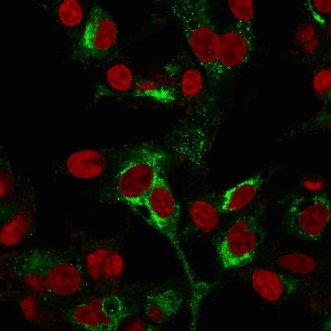 AFP (Alpha Fetoprotein) Antibody in Immunocytochemistry (ICC/IF)