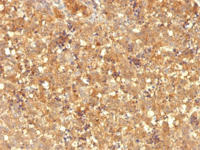 AFP (Alpha Fetoprotein) (Hepatocellular/Germ Cell Tumor Marker) Antibody in Immunohistochemistry (Paraffin) (IHC (P))