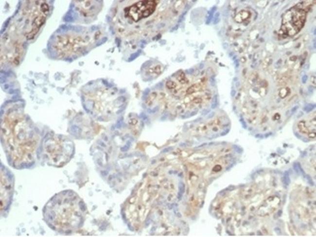 AFP (Alpha Fetoprotein) (Hepatocellular/Germ Cell Tumor Marker) Antibody in Immunohistochemistry (Paraffin) (IHC (P))