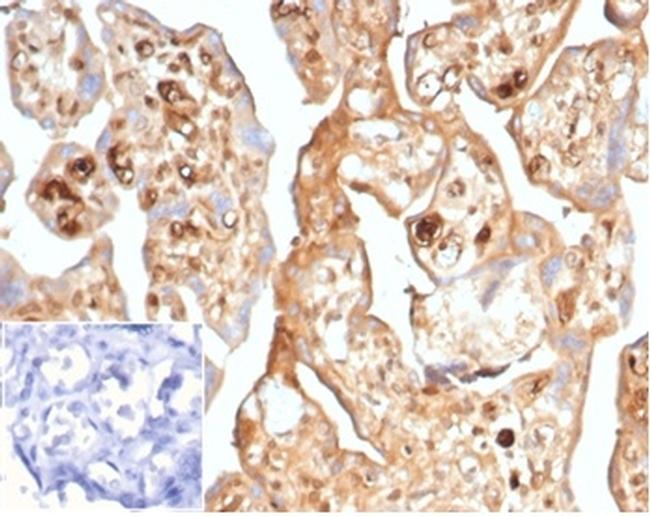 AFP (Alpha Fetoprotein) (Hepatocellular/Germ Cell Tumor Marker) Antibody in Immunohistochemistry (Paraffin) (IHC (P))