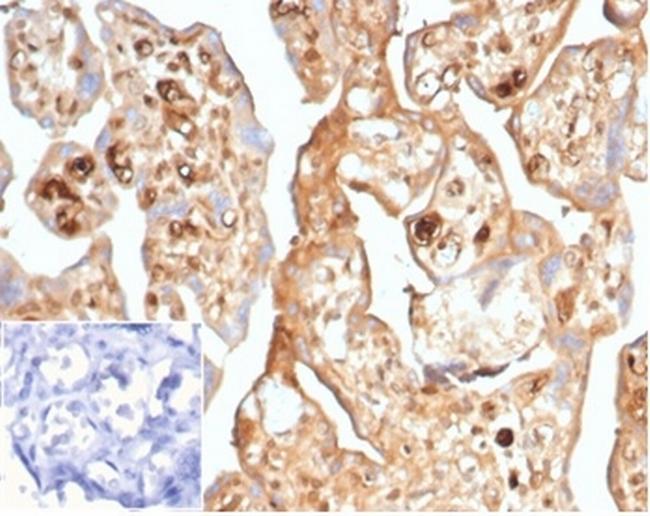 AFP (Alpha Fetoprotein) (Hepatocellular/Germ Cell Tumor Marker) Antibody in Immunohistochemistry (Paraffin) (IHC (P))