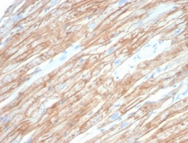 Dystrophin (DMD) (Marker of Duchenne and Becker Muscular Dystrophy) Antibody in Immunohistochemistry (Paraffin) (IHC (P))