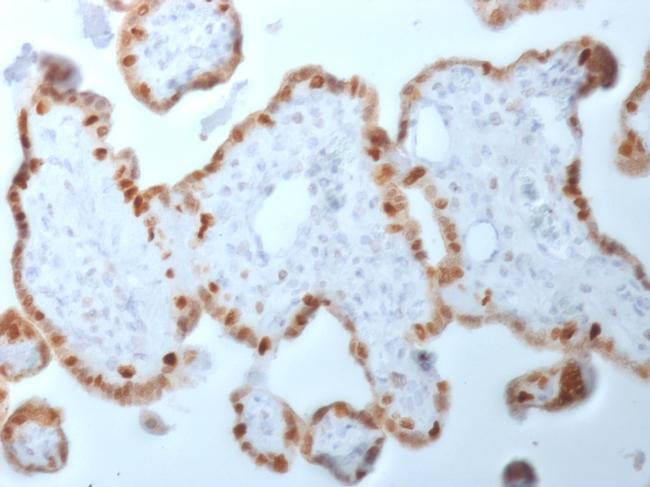 DNMT1/DNA Methyltransferase 1 Antibody in Immunohistochemistry (Paraffin) (IHC (P))