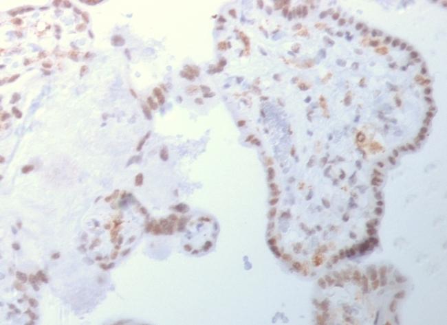 DNMT3A/DNA Methyltransferase 3 Alpha Antibody in Immunohistochemistry (Paraffin) (IHC (P))