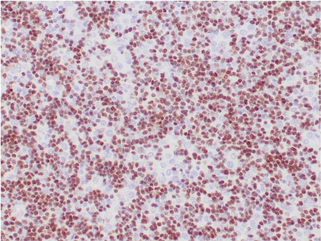 TdT/DNA Nucleotidylexotransferase Antibody in Immunohistochemistry (Paraffin) (IHC (P))