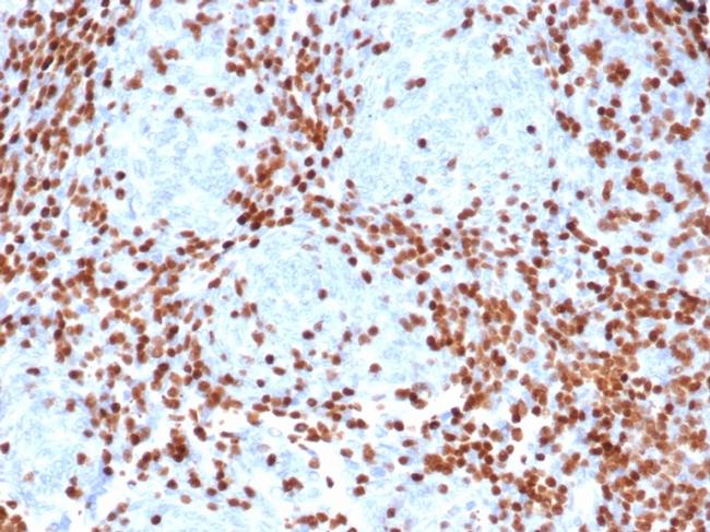 TdT/DNA Nucleotidylexotransferase (Acute Lymphoblastic Leukemia Marker) Antibody in Immunohistochemistry (Paraffin) (IHC (P))