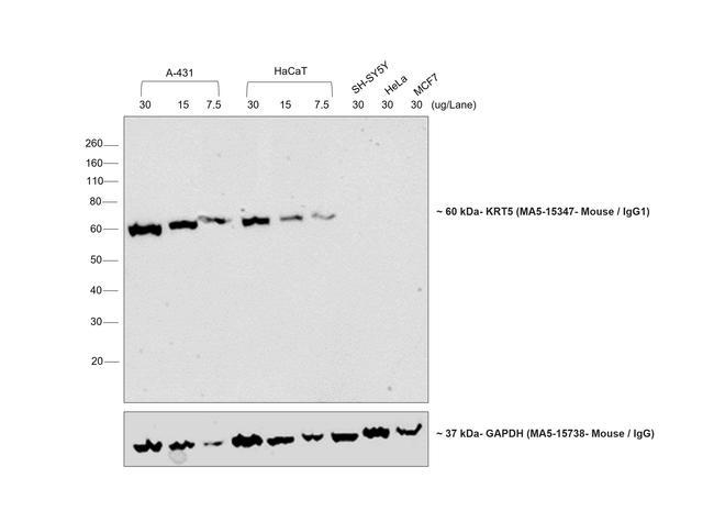 Mouse IgG1 Secondary Antibody in Western Blot (WB)