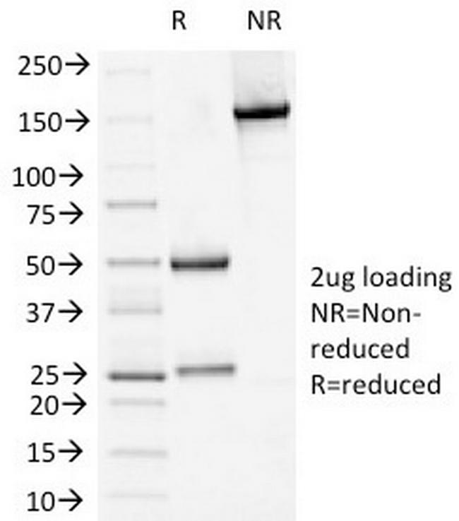 Desmoglein-1 (DSG1) Antibody in SDS-PAGE (SDS-PAGE)