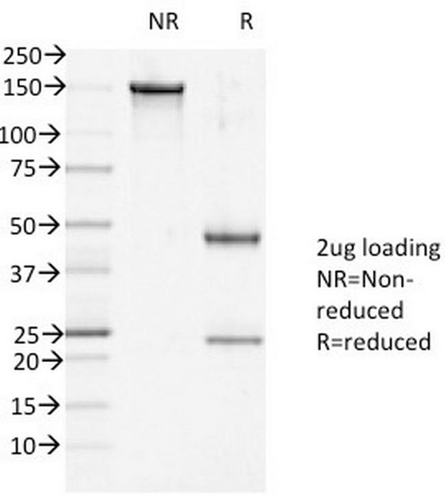 Desmoglein-1 (DSG1) Antibody in SDS-PAGE (SDS-PAGE)