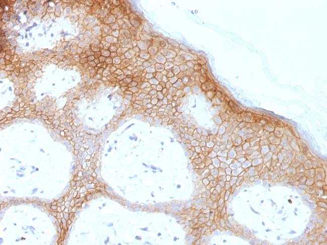 Desmoglein-1 (DSG1) Antibody in Immunohistochemistry (Paraffin) (IHC (P))