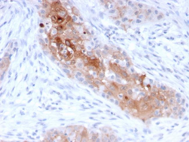 Desmoglein-1 (DSG1) Antibody in Immunohistochemistry (Paraffin) (IHC (P))