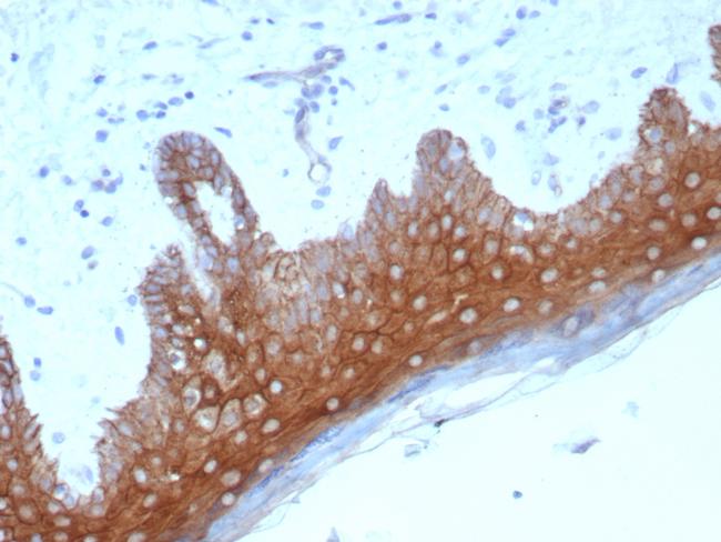 Desmoglein-1 (DSG1) Antibody in Immunohistochemistry (Paraffin) (IHC (P))