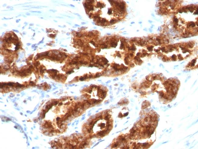 TAG-72/CA72.4 (Tumor-Associated Glycoprotein) Antibody in Immunohistochemistry (Paraffin) (IHC (P))