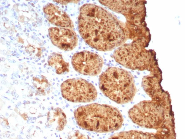 TAG-72/CA72.4 (Tumor-Associated Glycoprotein) Antibody in Immunohistochemistry (Paraffin) (IHC (P))