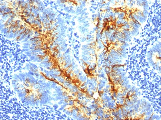 TAG-72/CA72.4 (Tumor-Associated Glycoprotein) Antibody in Immunohistochemistry (Paraffin) (IHC (P))