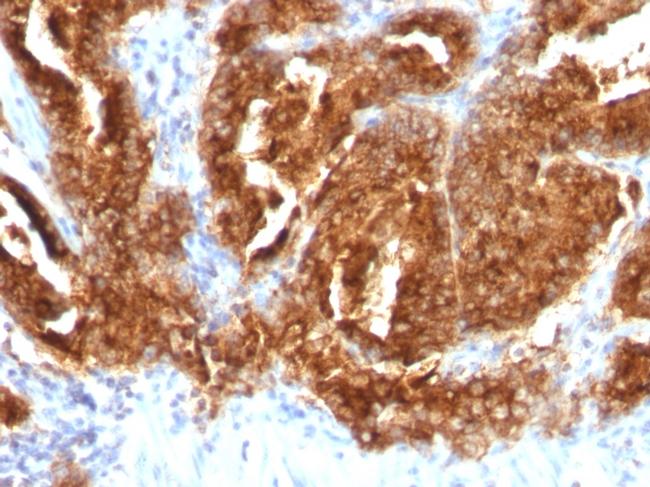 TAG-72/CA72.4 (Tumor-Associated Glycoprotein) Antibody in Immunohistochemistry (Paraffin) (IHC (P))