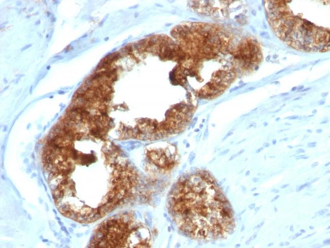 TAG-72/CA72.4 (Tumor-Associated Glycoprotein) Antibody in Immunohistochemistry (Paraffin) (IHC (P))