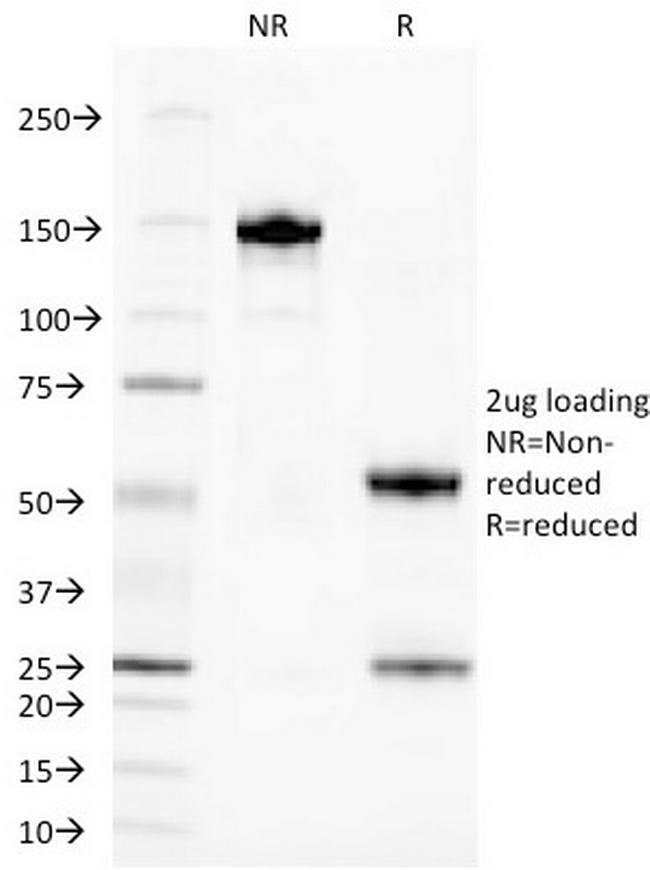 TAG-72/CA72.4 (Tumor-Associated Glycoprotein) Antibody in SDS-PAGE (SDS-PAGE)