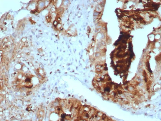 TAG-72/CA72.4 (Tumor-Associated Glycoprotein) Antibody in Immunohistochemistry (Paraffin) (IHC (P))