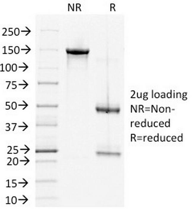 Desmoglein-2 (DSG2) Antibody in SDS-PAGE (SDS-PAGE)