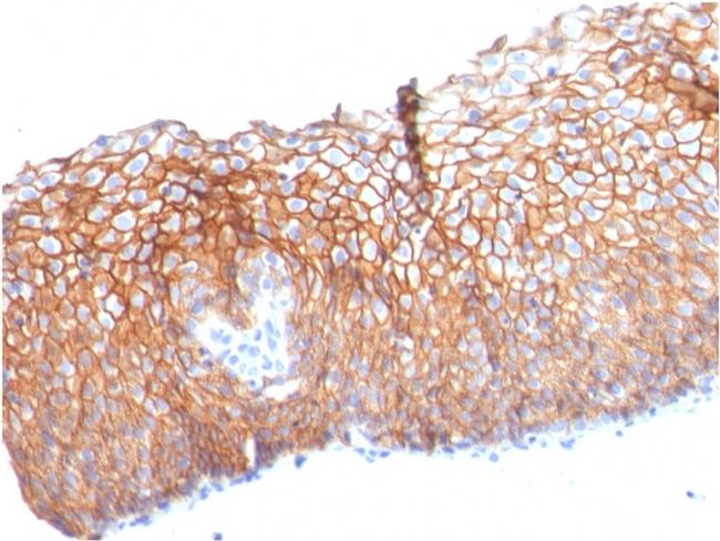 Desmoglein-3 Antibody in Immunohistochemistry (Paraffin) (IHC (P))