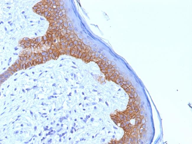 Desmoglein-3 (Squamous Cell Marker) Antibody in Immunohistochemistry (Paraffin) (IHC (P))