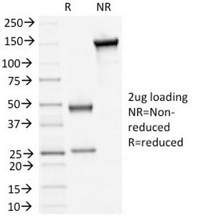 Desmoglein-3 (Squamous Cell Marker) Antibody in SDS-PAGE (SDS-PAGE)