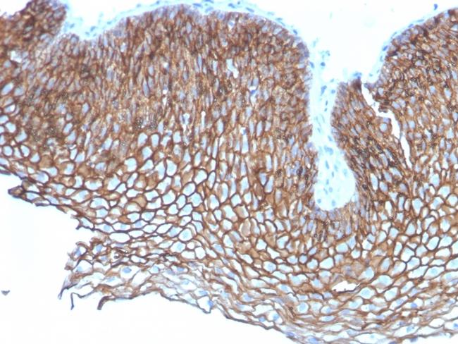 Desmoglein-3 (Squamous Cell Marker) Antibody in Immunohistochemistry (Paraffin) (IHC (P))