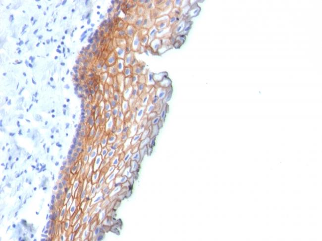 Desmoglein-3 Antibody in Immunohistochemistry (Paraffin) (IHC (P))