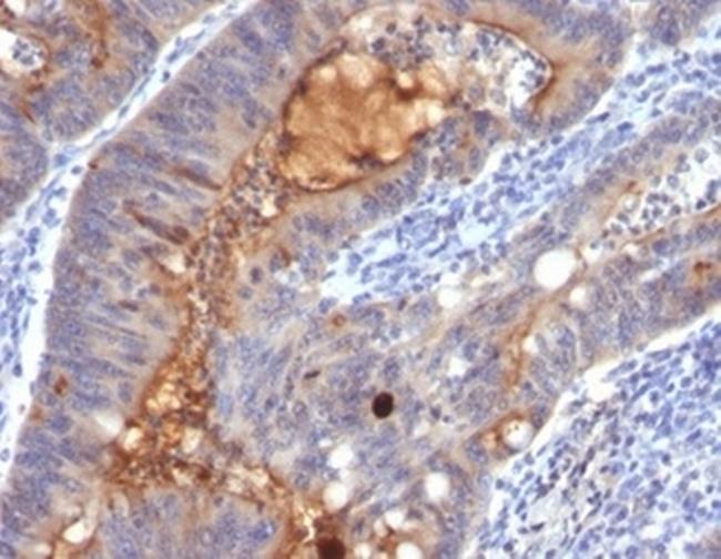 IgA Secretory Component/ECM1 Antibody in Immunohistochemistry (Paraffin) (IHC (P))