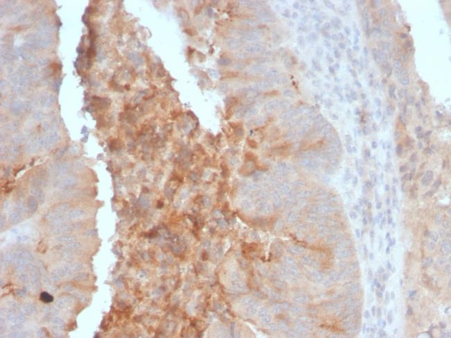 IgA Secretory Component/ECM1 Antibody in Immunohistochemistry (Paraffin) (IHC (P))